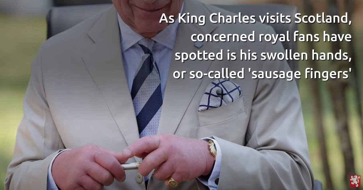 King Charles Joked About His "Sausage-Like Fingers" - DSF Antique Jewelry